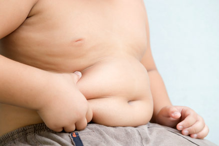 ילדים בעלי עודף משקל סובלים חברתית ואנחנו צריכים למנוע זאת